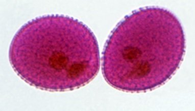 dois grãos de pólen visualizados em ultramicroscópio. Do lírio.